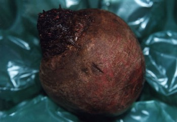 Beetroot