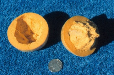 Casimiroa, White sapote